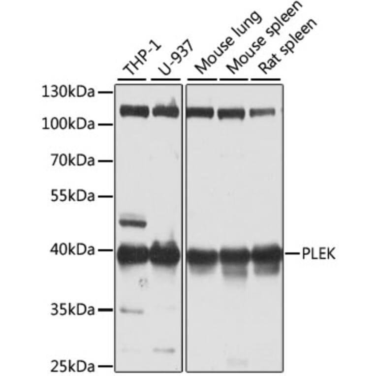 Western Blot - Anti-Pleckstrin Antibody (A15160) - Antibodies.com