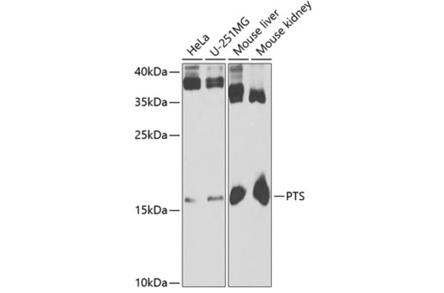 Western Blot - Anti-PTS/PTPS Antibody (A15161) - Antibodies.com