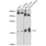 Western Blot - Anti-PTS/PTPS Antibody (A15161) - Antibodies.com