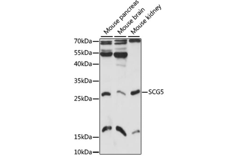Western Blot - Anti-SCG5 Antibody (A6308) - Antibodies.com