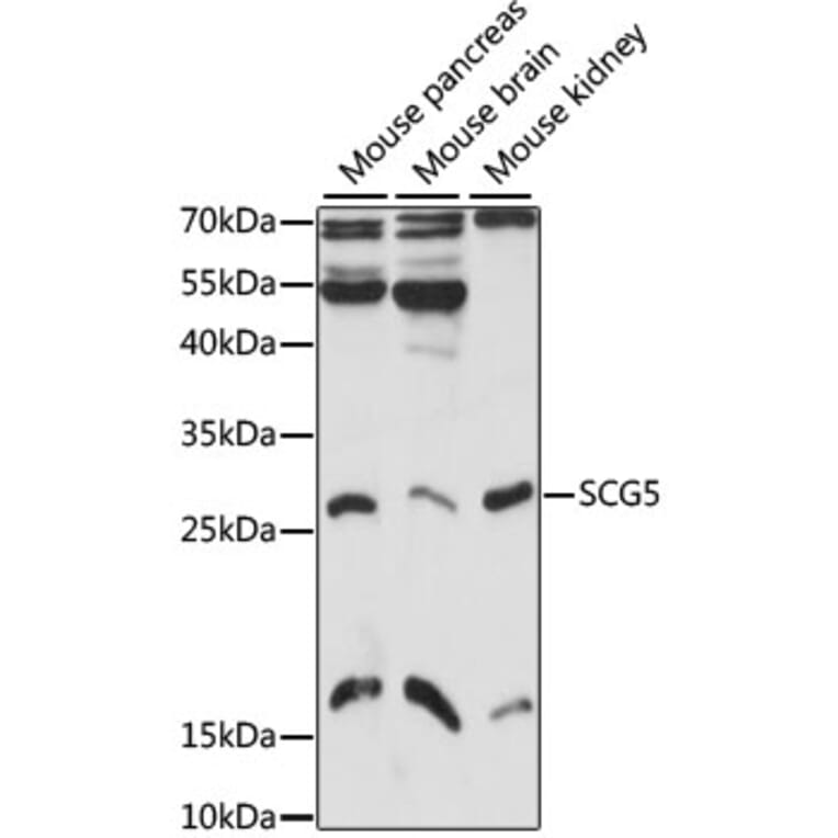 Western Blot - Anti-SCG5 Antibody (A6308) - Antibodies.com