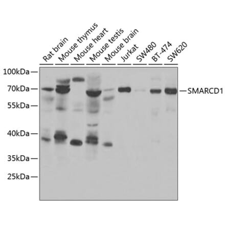 Western Blot - Anti-SMARCD1 Antibody (A15163) - Antibodies.com