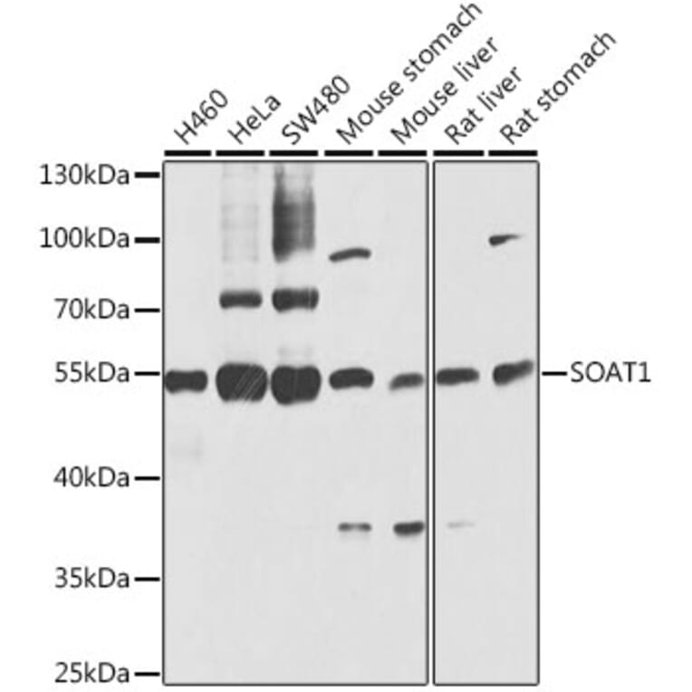 Western Blot - Anti-SOAT 1/ACAT1 Antibody (A15164) - Antibodies.com