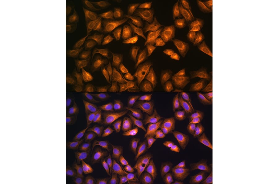 Immunofluorescence - Anti-SOAT 1/ACAT1 Antibody (A15164) - Antibodies.com