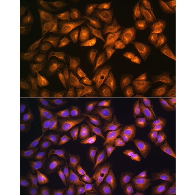Immunofluorescence - Anti-SOAT 1/ACAT1 Antibody (A15164) - Antibodies.com