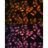 Immunofluorescence - Anti-SOAT 1/ACAT1 Antibody (A15164) - Antibodies.com