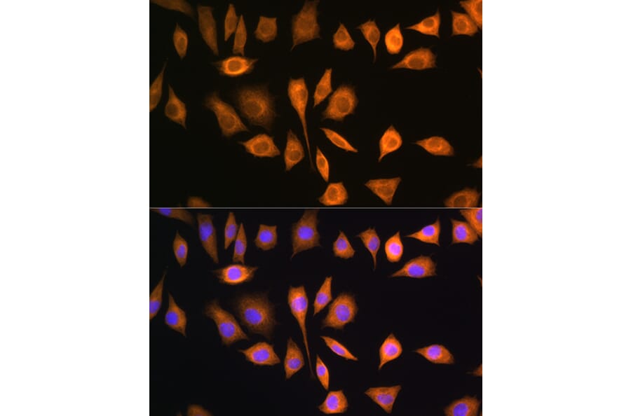 Immunofluorescence - Anti-SOAT 1/ACAT1 Antibody (A15164) - Antibodies.com