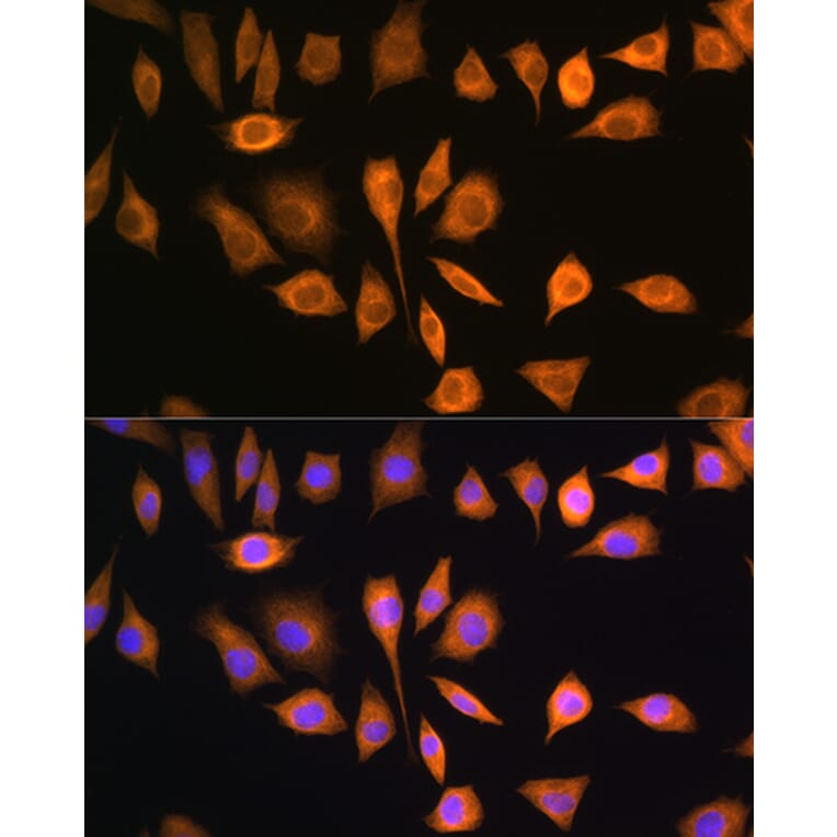 Immunofluorescence - Anti-SOAT 1/ACAT1 Antibody (A15164) - Antibodies.com