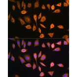 Immunofluorescence - Anti-SOAT 1/ACAT1 Antibody (A15164) - Antibodies.com