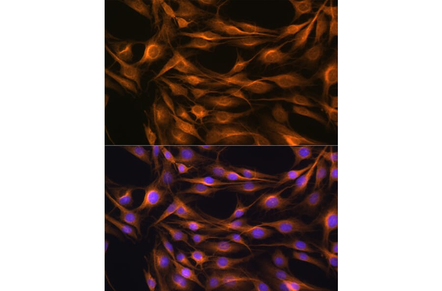 Immunofluorescence - Anti-SOAT 1/ACAT1 Antibody (A15164) - Antibodies.com