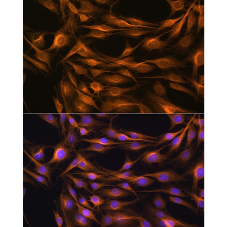 Immunofluorescence - Anti-SOAT 1/ACAT1 Antibody (A15164) - Antibodies.com