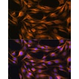 Immunofluorescence - Anti-SOAT 1/ACAT1 Antibody (A15164) - Antibodies.com
