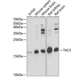 Western Blot - Anti-NKB Antibody (A15165) - Antibodies.com