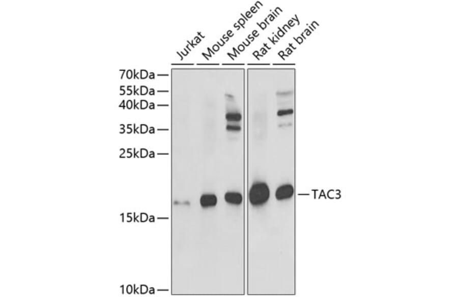 Western Blot - Anti-NKB Antibody (A15165) - Antibodies.com