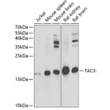 Western Blot - Anti-NKB Antibody (A15165) - Antibodies.com
