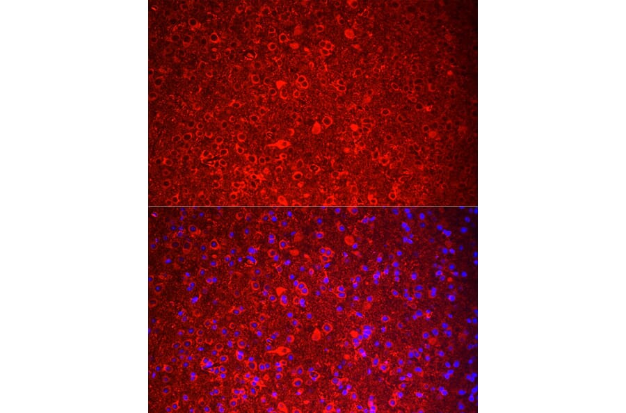 Immunofluorescence - Anti-NKB Antibody (A15165) - Antibodies.com