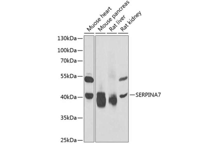 Western Blot - Anti-Thyroxine Binding Globulin Antibody (A15166) - Antibodies.com