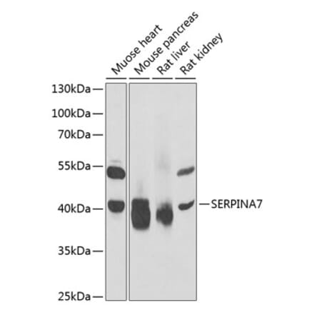 Western Blot - Anti-Thyroxine Binding Globulin Antibody (A15166) - Antibodies.com