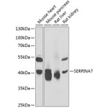 Western Blot - Anti-Thyroxine Binding Globulin Antibody (A15166) - Antibodies.com