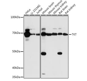 Western Blot - Anti-Transketolase Antibody (A15167) - Antibodies.com