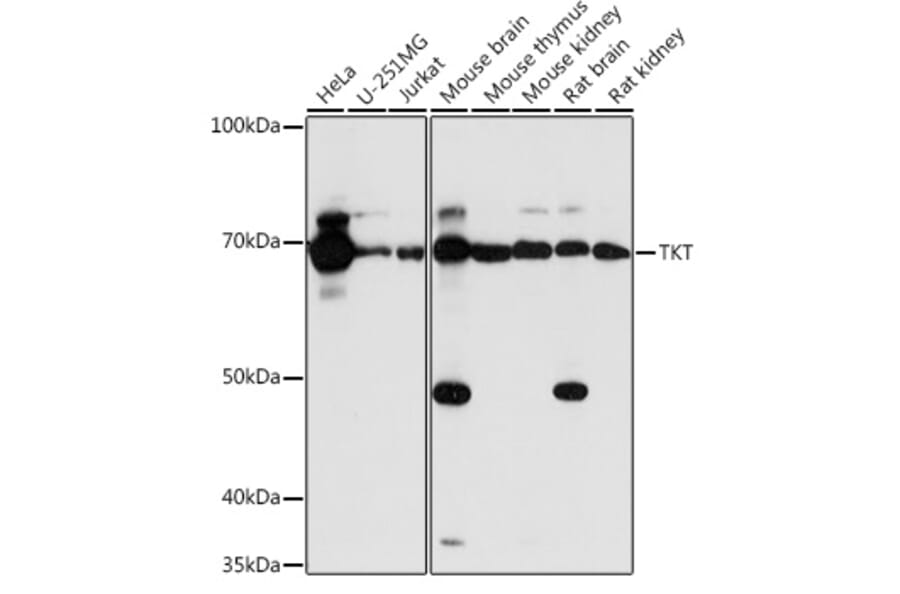 Western Blot - Anti-Transketolase Antibody (A15167) - Antibodies.com