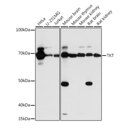 Western Blot - Anti-Transketolase Antibody (A15167) - Antibodies.com