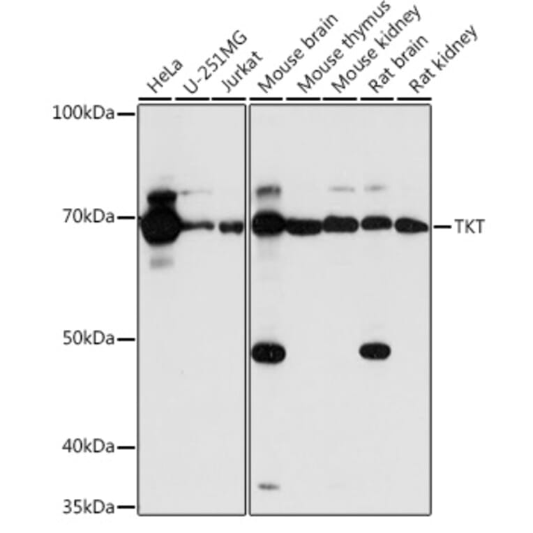 Western Blot - Anti-Transketolase Antibody (A15167) - Antibodies.com