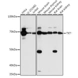 Western Blot - Anti-Transketolase Antibody (A15167) - Antibodies.com