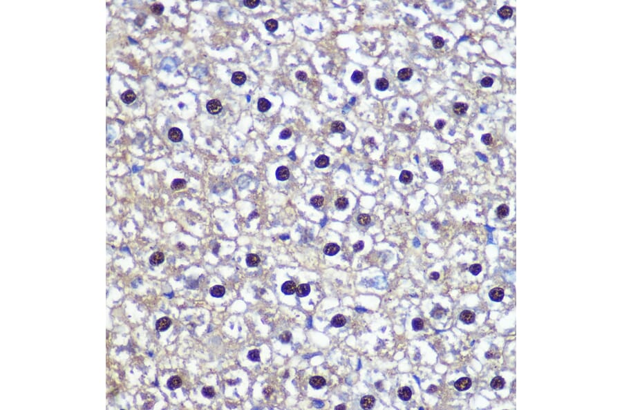 Immunohistochemistry - Anti-Transketolase Antibody (A15167) - Antibodies.com