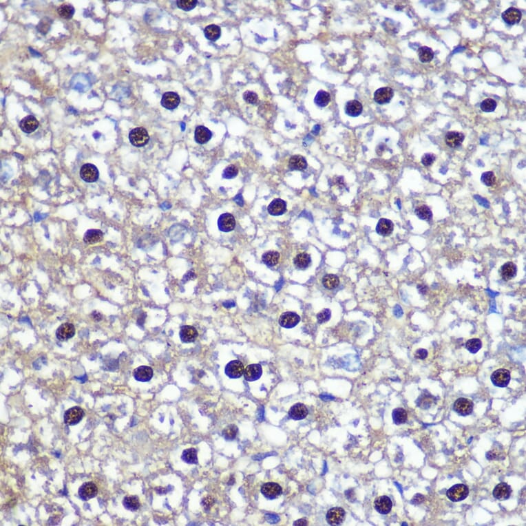 Immunohistochemistry - Anti-Transketolase Antibody (A15167) - Antibodies.com