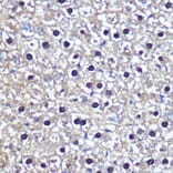 Immunohistochemistry - Anti-Transketolase Antibody (A15167) - Antibodies.com