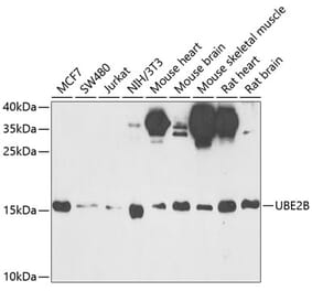 Western Blot - Anti-Ube2B Antibody (A15168) - Antibodies.com