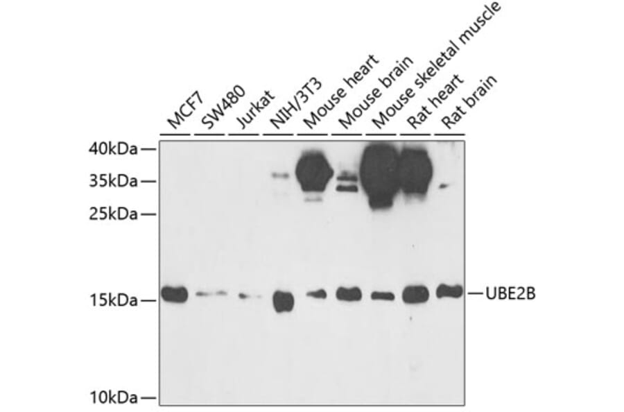 Western Blot - Anti-Ube2B Antibody (A15168) - Antibodies.com
