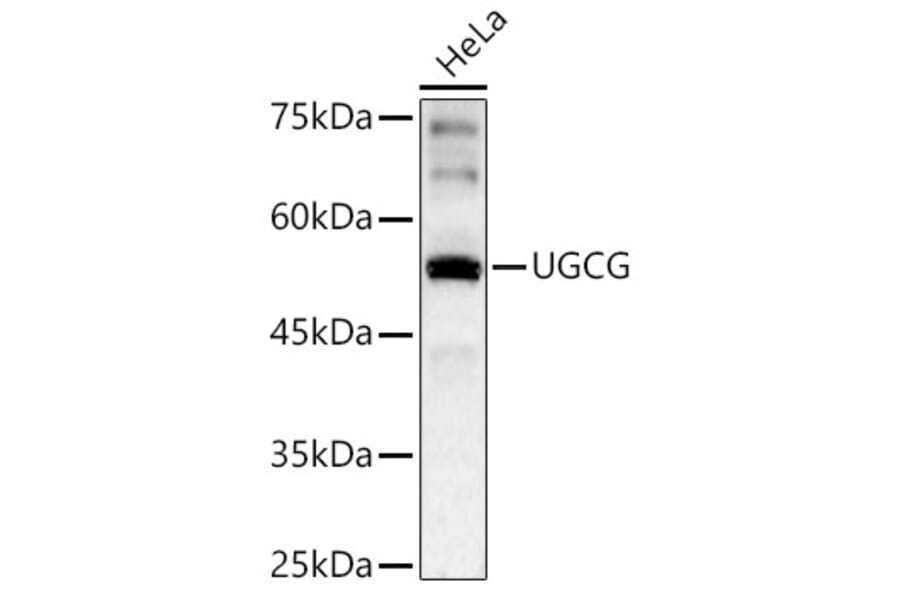 Western Blot - Anti-Ceramide glucosyltransferase Antibody (A15169) - Antibodies.com