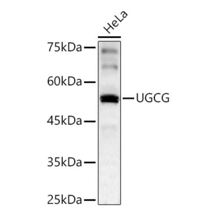 Western Blot - Anti-Ceramide glucosyltransferase Antibody (A15169) - Antibodies.com