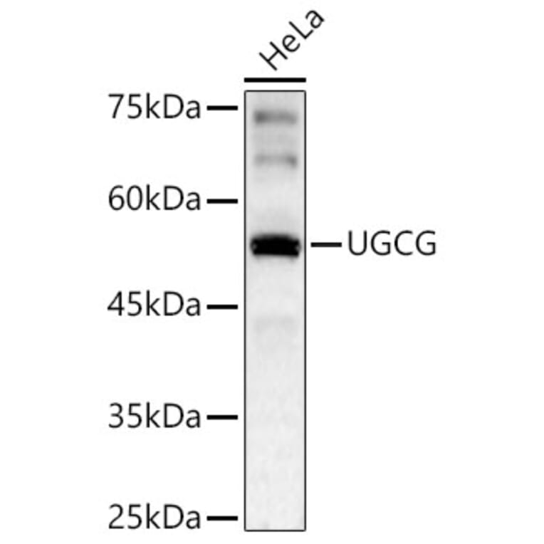 Western Blot - Anti-Ceramide glucosyltransferase Antibody (A15169) - Antibodies.com
