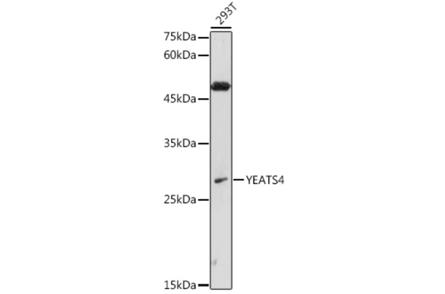 Western Blot - Anti-GAS41 Antibody (A15170) - Antibodies.com