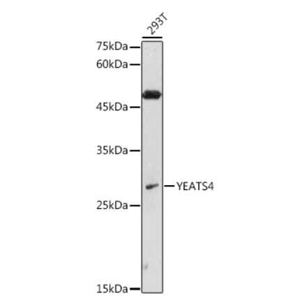 Western Blot - Anti-GAS41 Antibody (A15170) - Antibodies.com