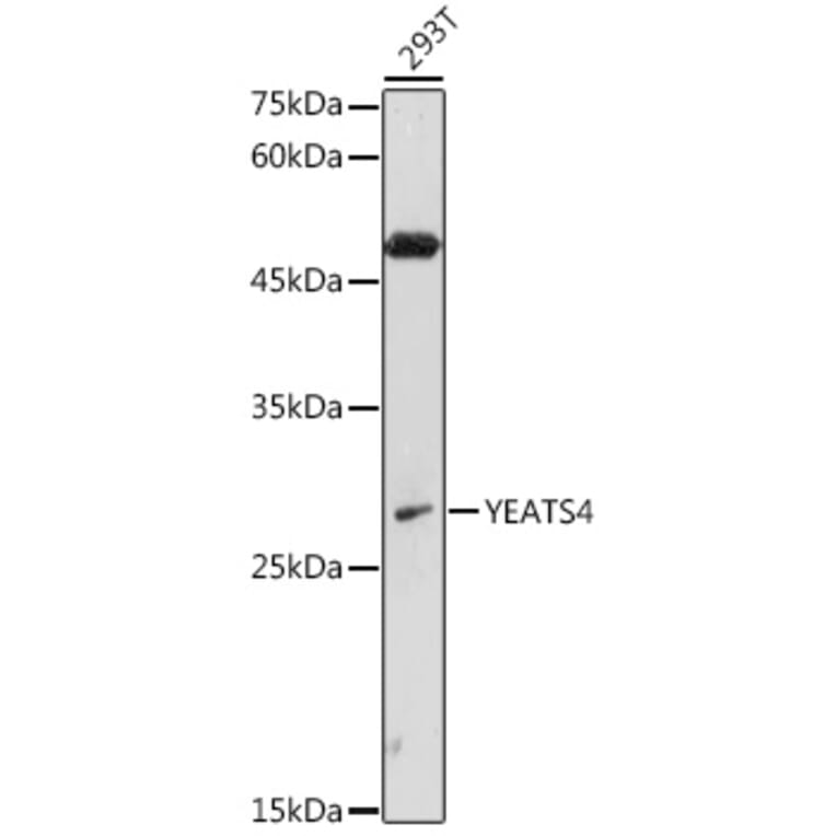 Western Blot - Anti-GAS41 Antibody (A15170) - Antibodies.com