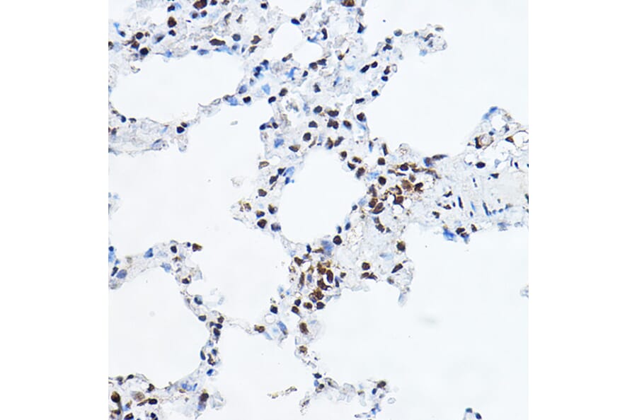 Immunohistochemistry - Anti-GAS41 Antibody (A15170) - Antibodies.com