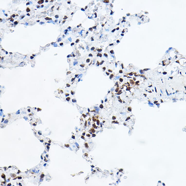 Immunohistochemistry - Anti-GAS41 Antibody (A15170) - Antibodies.com