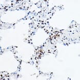 Immunohistochemistry - Anti-GAS41 Antibody (A15170) - Antibodies.com