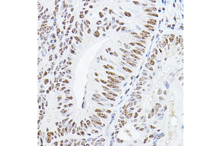 Immunohistochemistry - Anti-GAS41 Antibody (A15170) - Antibodies.com