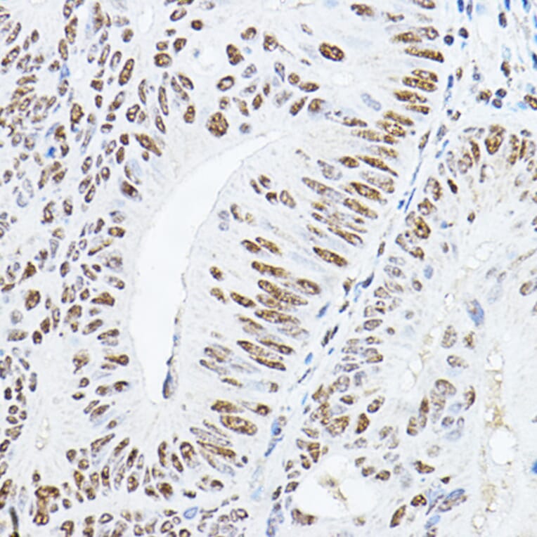 Immunohistochemistry - Anti-GAS41 Antibody (A15170) - Antibodies.com
