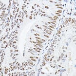 Immunohistochemistry - Anti-GAS41 Antibody (A15170) - Antibodies.com