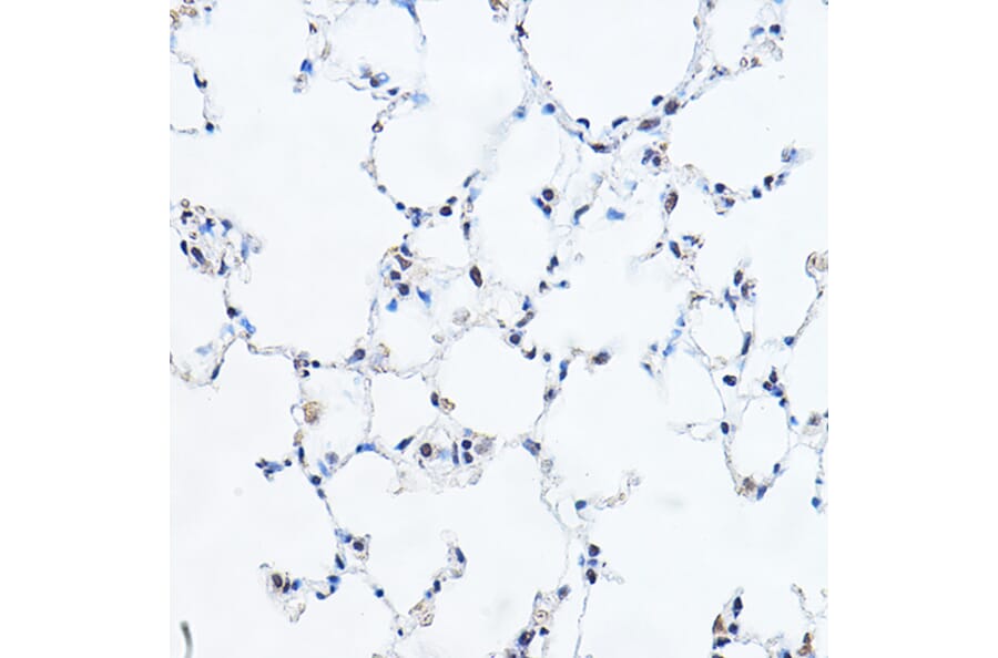 Immunohistochemistry - Anti-GAS41 Antibody (A15170) - Antibodies.com