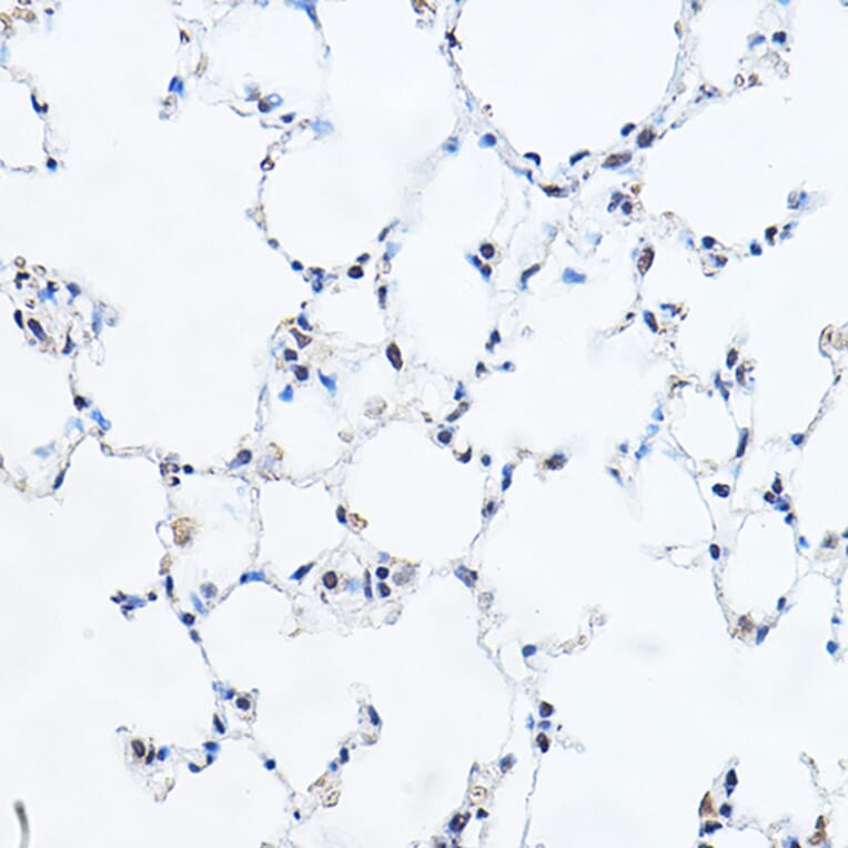 Immunohistochemistry - Anti-GAS41 Antibody (A15170) - Antibodies.com