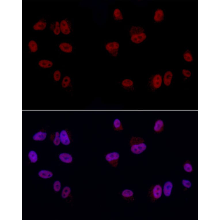 Immunofluorescence - Anti-GAS41 Antibody (A15170) - Antibodies.com