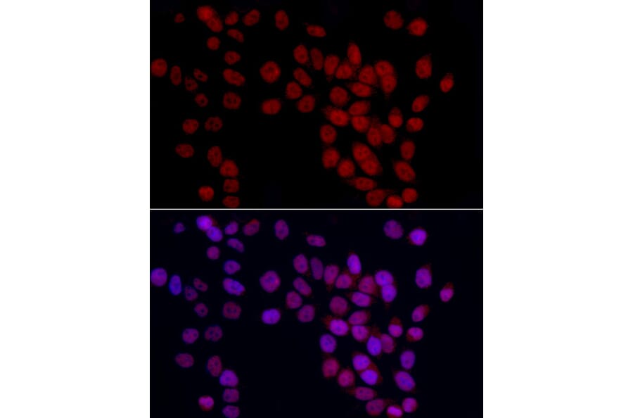Immunofluorescence - Anti-GAS41 Antibody (A15170) - Antibodies.com