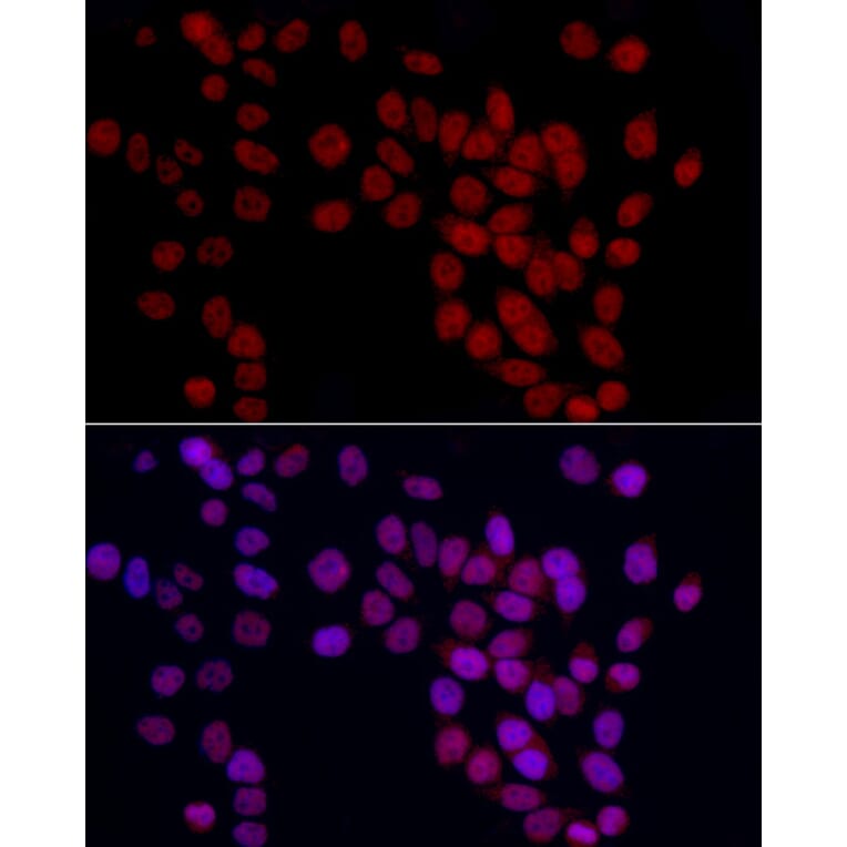 Immunofluorescence - Anti-GAS41 Antibody (A15170) - Antibodies.com